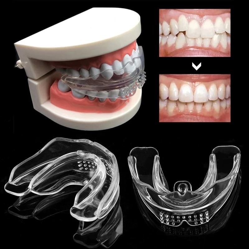 Bretelles-orthodontiques-dentaires-invisibles-pour