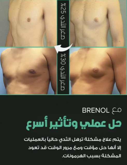 Brinol P6